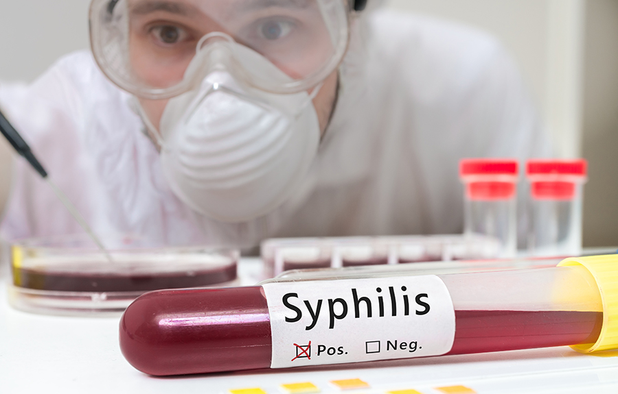 Syphilis, other STDs are on the rise but states lost millions of