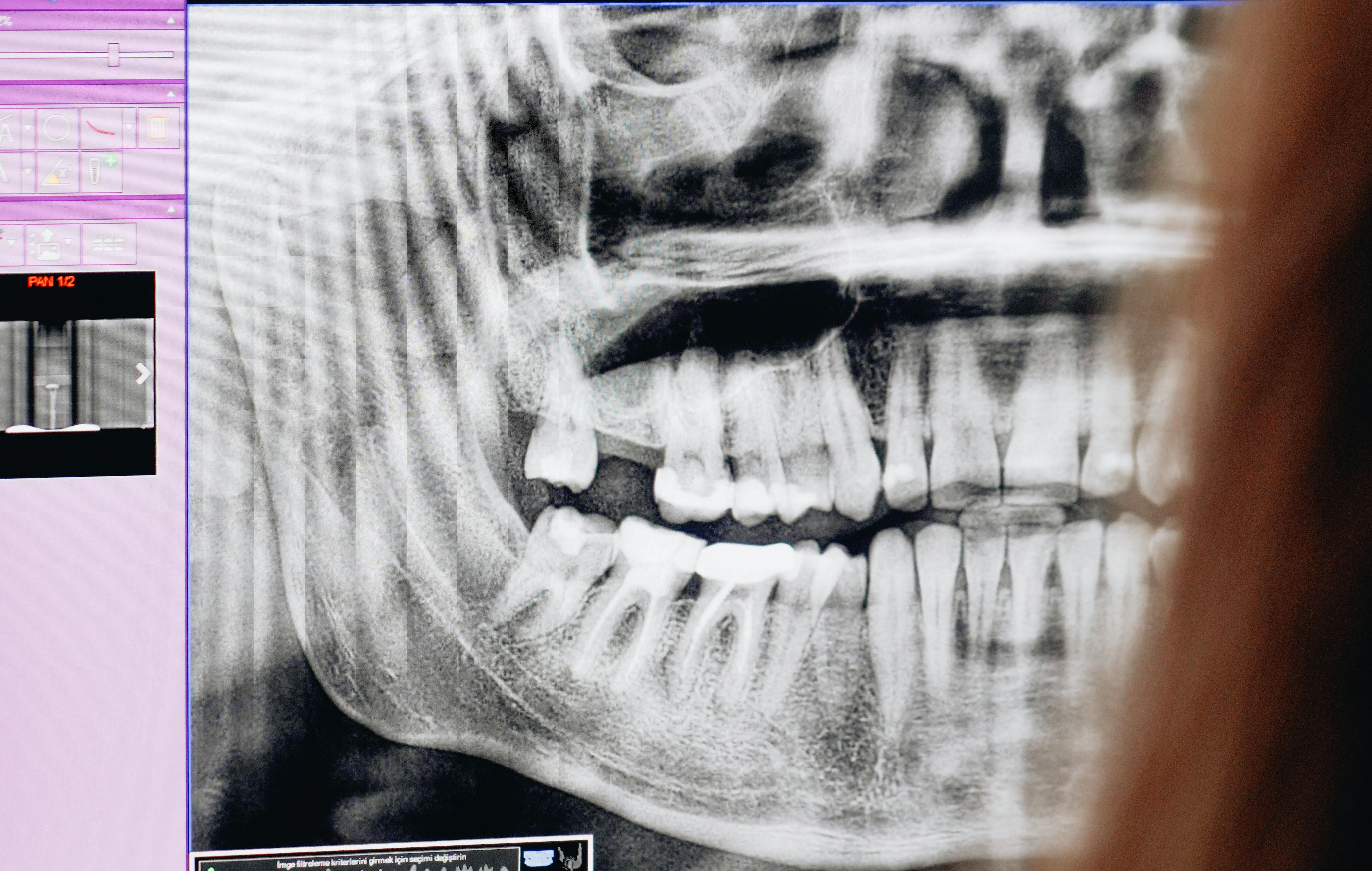 What’s the big deal about dental health and pregnancy?